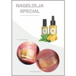 Nagelolja Special före- och efter bild