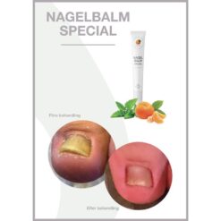 Nagelbalm Special före- och efter bild