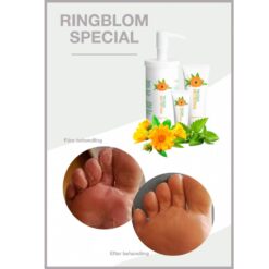 Rinblom Special före- och efter bild